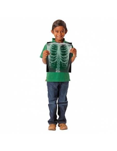 Rayos-X Cuerpo Humano