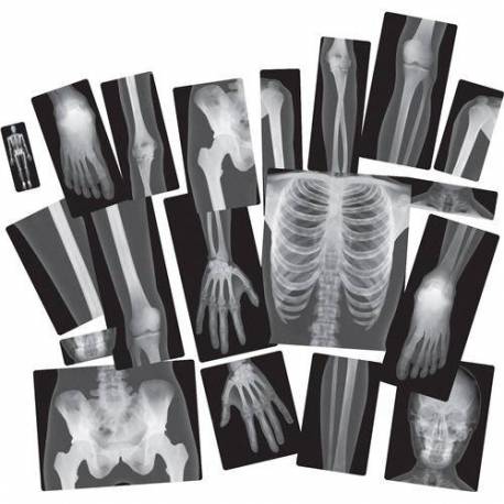 Rayos-X Cuerpo Humano Roylco Ciencia y medio ambiente