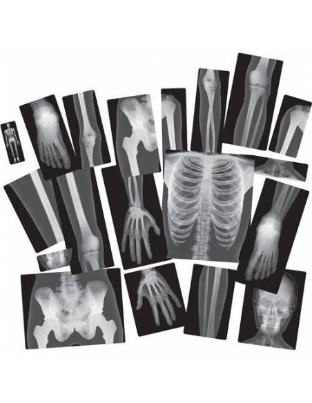 Rayos-X Cuerpo Humano  Ciencia y medio ambiente