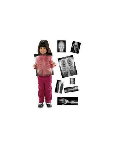 Rayos-X Cuerpo Humano