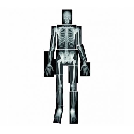 Rayos-X Cuerpo Humano