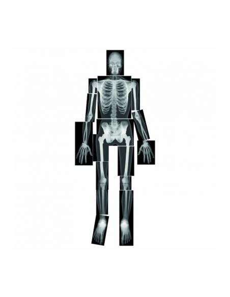 Rayos-X Cuerpo Humano