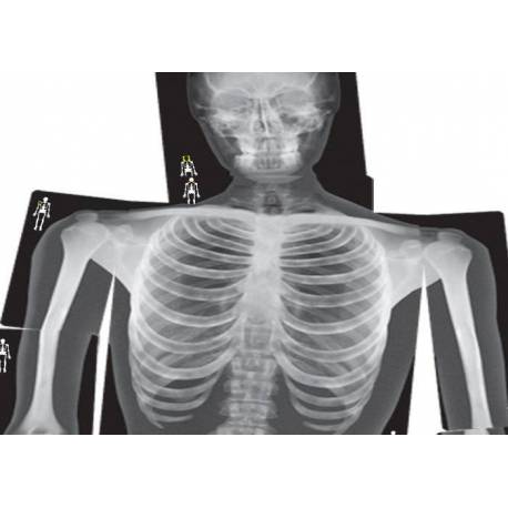 Rayos-X Cuerpo Humano