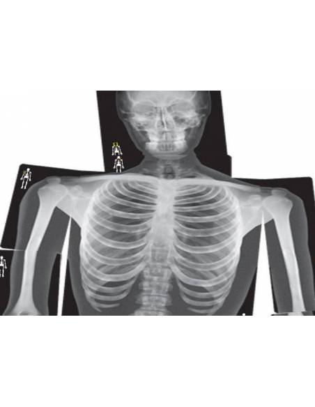 Rayos-X Cuerpo Humano