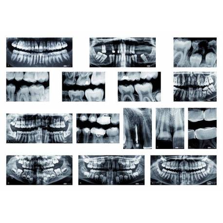 Rayos X Dentales 2
